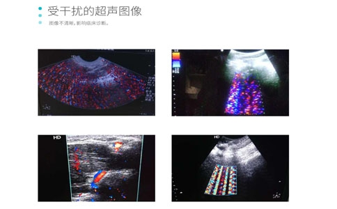 影像干扰解决方案